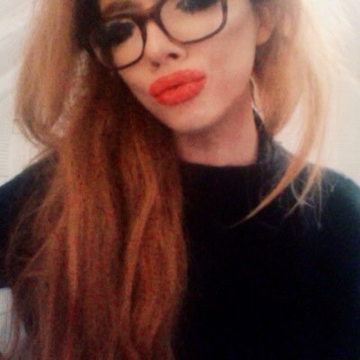 Fighting The Fight Against Anorexia. Currently Outpatient. Ask for a follow back!