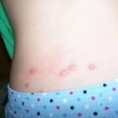 We Clean Bed Bugs is a bedbug control company in Edmonton that serves residential, commercial, and institutional clients.