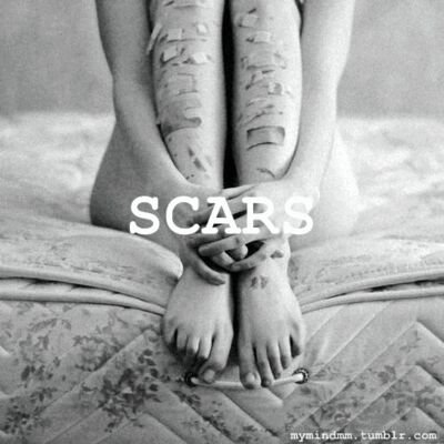 I have so many things wrong with me I'm like a broken toy