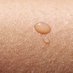 Melanoma News Today (@newsmelanoma) Twitter profile photo