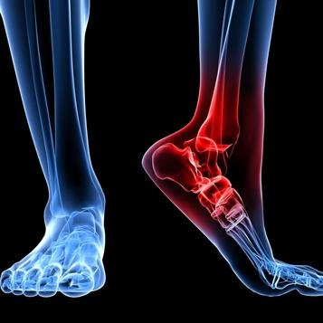 A qualified Chiropodist with over 14 years experience. Member of Institute of Chiropodist and Podiatrist Registered with the HCPC & CRB Registered.