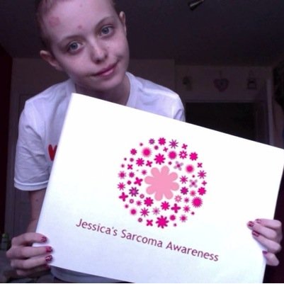 Jessica Robson, Diagnosed with cancer at 14 in 2010, Jess now raising thousands to help other Teenagers living with cancer.