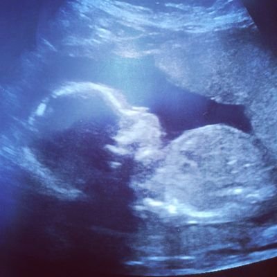 ♥♥Child Of God/Mommy/Nurse/Enjoying the life God Has Given Me♥♥