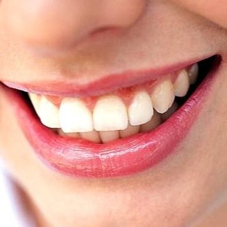 Conformamos un equipo de profesionales, dedicados a la atencion odontologica integral .Nuestro telefono 4431-6987