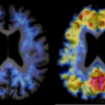 HAIconference's profile picture. The 18th Annual Human Amyloid Imaging Conference will be held January 12-14, 2025 at the Puerto Rico Convention Center in San Juan.