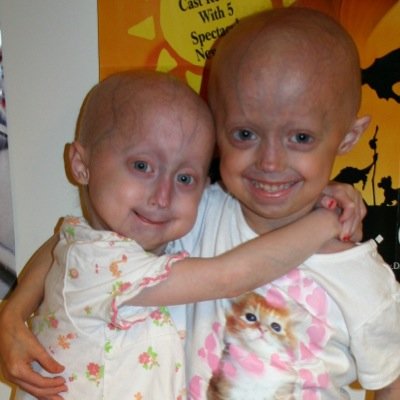 Progeria Awareness