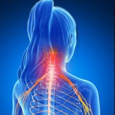 neckhernia, cervical degenerative disc, spinale hernia, discus intervertebralis, cervical herniated disc symptoms. cervical spine,neck pain, spondylosis