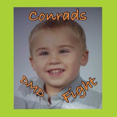 Conrad got diagnosed with Duchenne at age 4. Hes had operations on both his eyes (squint) & Enlarged kidney. He started suffering from Seizures in Dec 2012