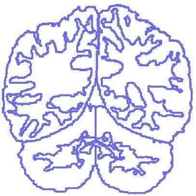 Probabilistic Neuroanatomy created by labeling MRI brain scans