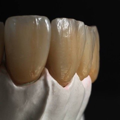 Laboratorio Dental de excelencia basado en fuertes valores que fundamentan nuestra Calidad y Servicio.