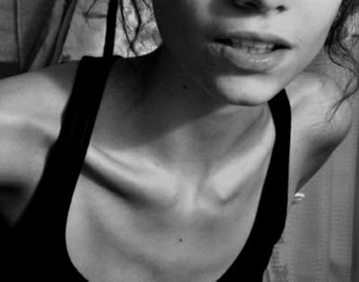 17 años. A y M| Fumadora, depresiva, nerviosa.| Peso inicial: 50kg. Peso actual:40kg. Meta: 37kg.| resistiendo.