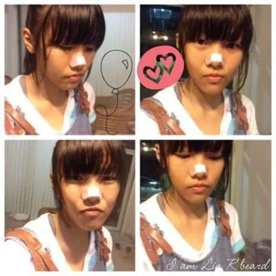 เหมือนเดิม.