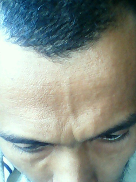 single