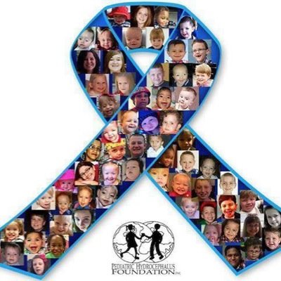 PA Chapter of the Pediatric Hydrocephalus Foundation, Inc. provides resources/support/funding a cure for #hydrocephalus. PHF is non-profit501(c)(3).