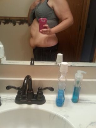 Ednos Fat Self harm Avi is me