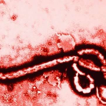 hi im ebola and i kill people through anal bleeding | im coming for you