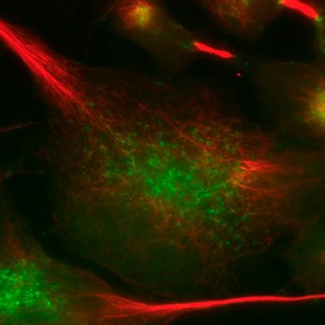 Prof of Neurogenetics and Molecular Neurobiology, Cambridge Uni. NHS Clinical Geneticist. Study membrane traffic and axonal degeneration in HSP. Personal views.