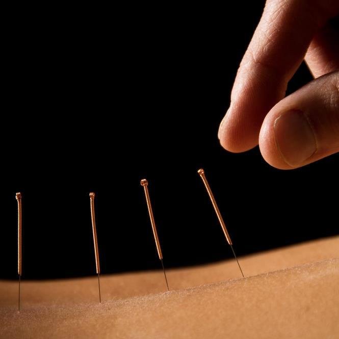 Experience Your Fullest Potential For A PainFree Body,A Peaceful Mind & a Lifetime of Ultimate Wellness.Massage, Acupuncture, Herbal medicine & Allergy testing.