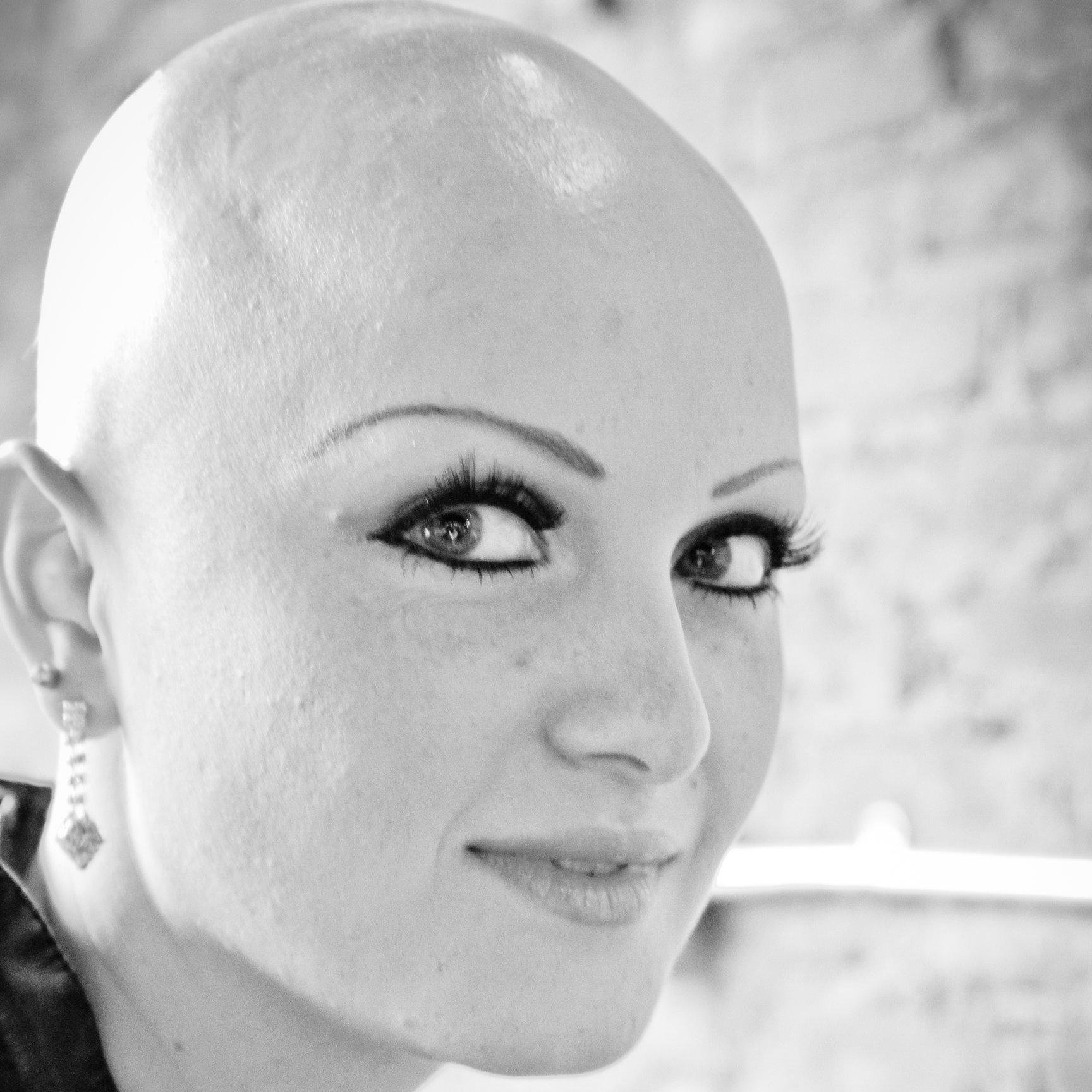 A Support Group for people with Alopecia Areata in and around Nashville, TN