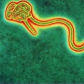Ebola2k14og's profile picture. Imma be the greatest disease yet