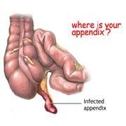 whereisappendix's profile picture. whereisyourappendix provides the health related information.