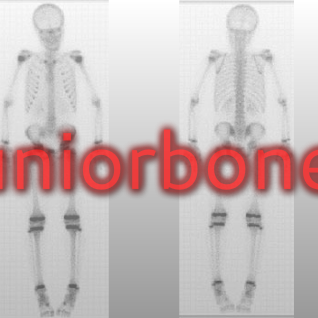 Junior Bones
