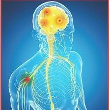 Your resource for free CME and CE educational activities designed for physicians, nurses, NPs and PAs who manage patients with multiple sclerosis.