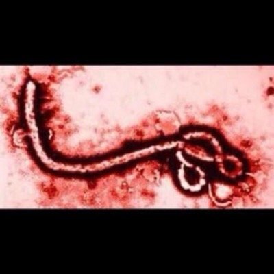 EBOLA