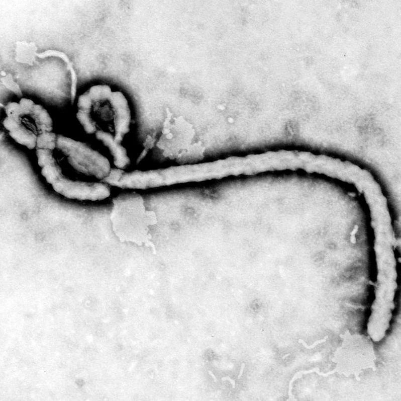 Postureo Ébola