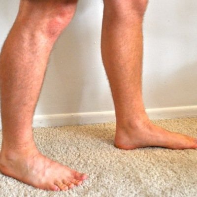 caldicotfeet's profile picture. Podiatrists/Chiropodists. Tucked away in a quiet corner of Caldicot, aiming to fulfil all your lower leg/foot treatment requirements! 01291 425343/07836 311757