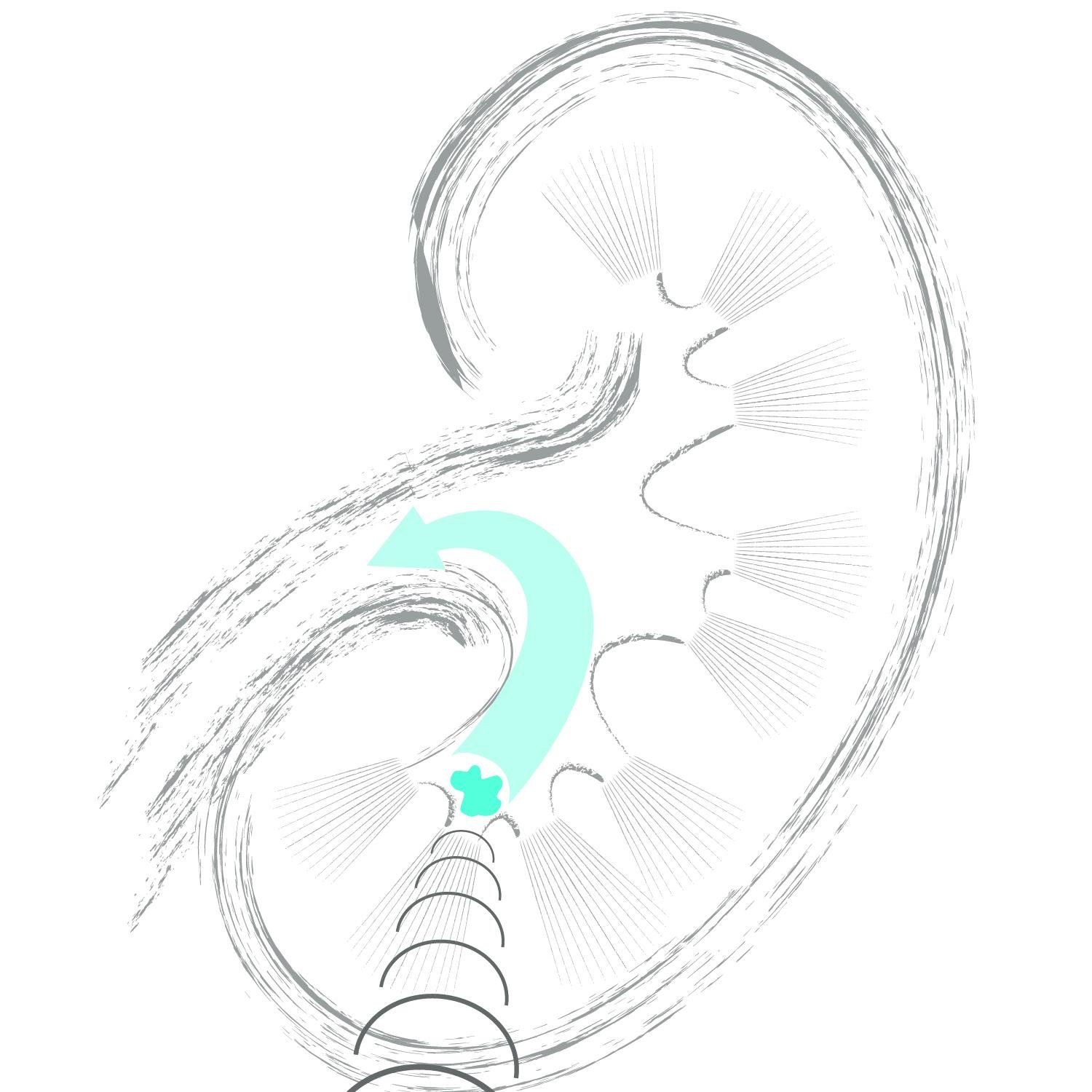 Sonomotion Profile