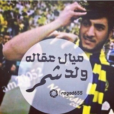 ‏‏‏طقطقه عالميهه على طواقي محليهه