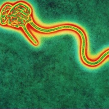 if you dont want ebola , wash yo damn self nasty motha fuckka. GOAL: i want to be the #1 virus