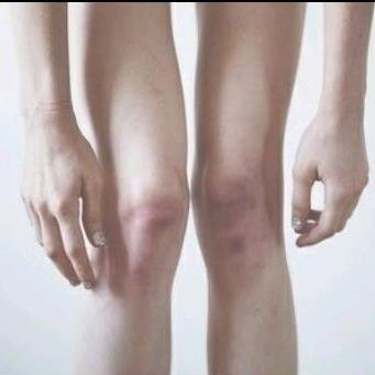 KleinBere's profile picture. Cuenta anónima. Peso inicial:58 Peso actual:37 Peso meta:35 Estatura:1.54