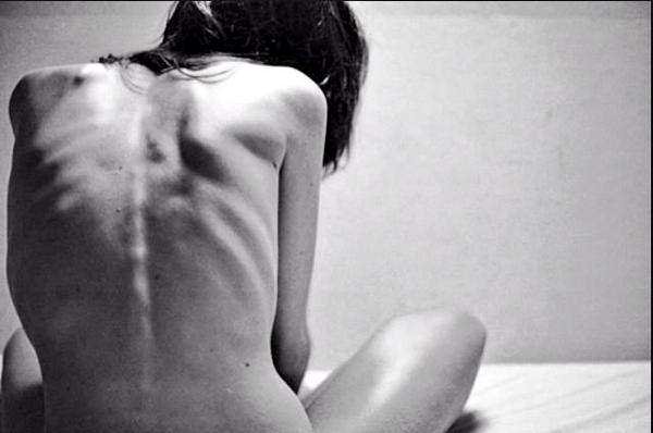 dreamsskinny279's profile picture. Need an Ana buddy asap// relapse//cw__ Gw:100lb ugw: 84// 5'4// account started 12/10/14 // dm for pin