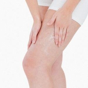problems that women have always complained about is cellulite, but take it we can heal