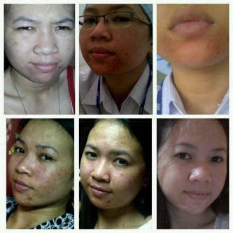 Chat me 085737190828 /284A32C9 for info/konsultasi/order/join