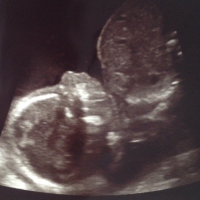 AbbyHewittxo's profile picture. Our Princess 20.02.15 ❤️