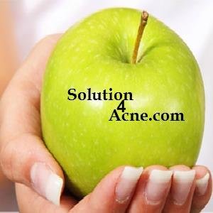 This site was created to provide helpful information for people suffering from acne. On this site you will find regularly updated information about acne