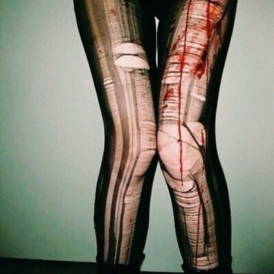 ana | mia | depression | anxiety | self harm