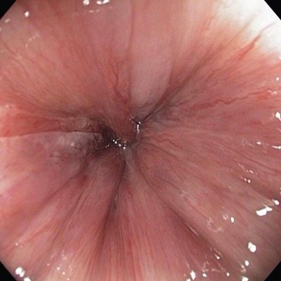 free nude fakes of celebs close up anus pics