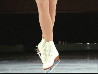 The typical problems of your average figure skater.