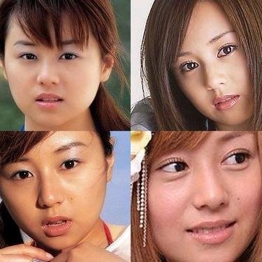 芸能人の整形疑惑。すっぴん、
卒アル、老化の激変わり画像。徹底検証！