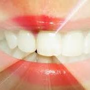 NepaliDental's profile picture. S. Nepali Dental Practices 76-78 Kenton Lane(Tel 0191 2852784) & 177 Medomsley Road Consett ( Tel 01207 502672) Offering a range of NHS and Private treatments