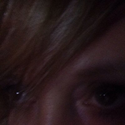 20+ RN veteran, bitchy, love cocktails, don't need approval. I wear pissed off real well. i use the ICD-9 724.79 a LOT!