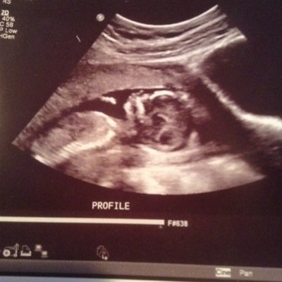Obsessive, controlling, need to be perfect, never good enough. First time mommy due Dec. 11th. 23 y/o F.
