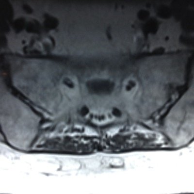 Retired radiologist who loved the practice of radiology.