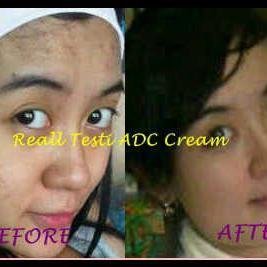 Menjual krim pencerah wajah ADC All Day Cream dan Krim SARI BPOM
sms: 085655503507 PIN: 28BB7231 FB: https://t.co/zs0BHWc9WR