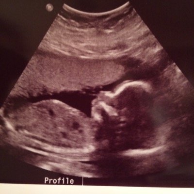 Mommy first...still a BOSS!