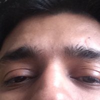 dr.apurva chitalia (@smileone1) 's Twitter Profile